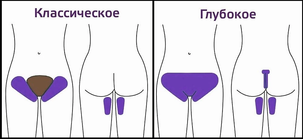 бикини.jpg